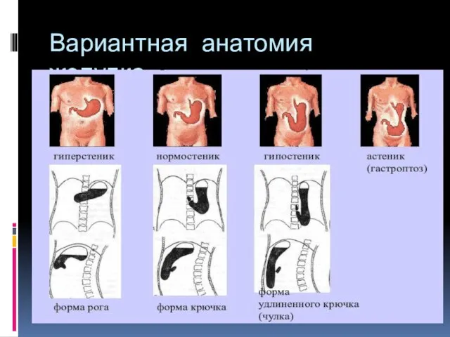 Вариантная анатомия желудка