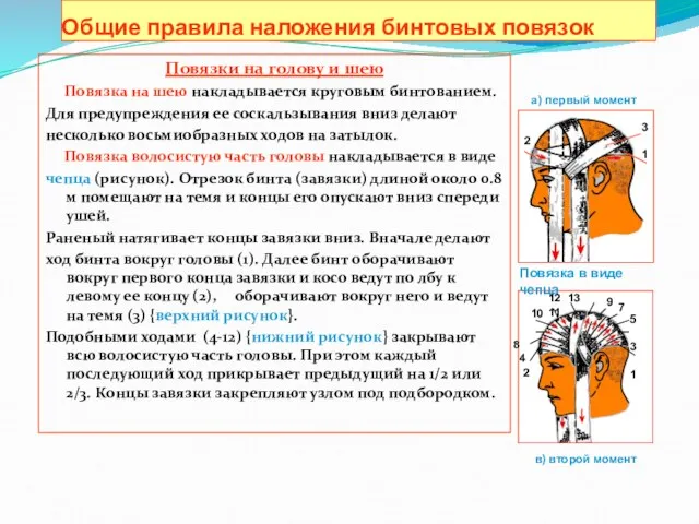 Общие правила наложения бинтовых повязок Повязки на голову и шею Повязка