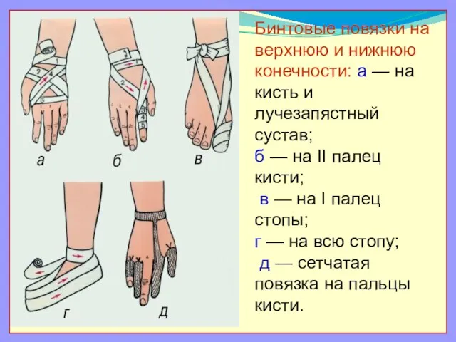 Бинтовые повязки на верхнюю и нижнюю конечности: а — на кисть