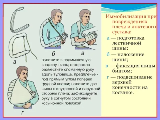 Иммобилизация при повреждениях плеча и локтевого сустава: а — подготовка лестничной