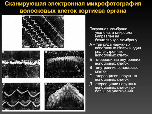 Сканирующая электронная микрофотография волосковых клеток кортиева органа Покровная мембрана удалена, а