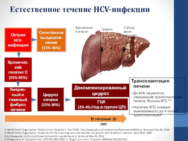 Естественное течение HCV-инфекции 1. World Health Organization. Media Centre: Hepatitis C.