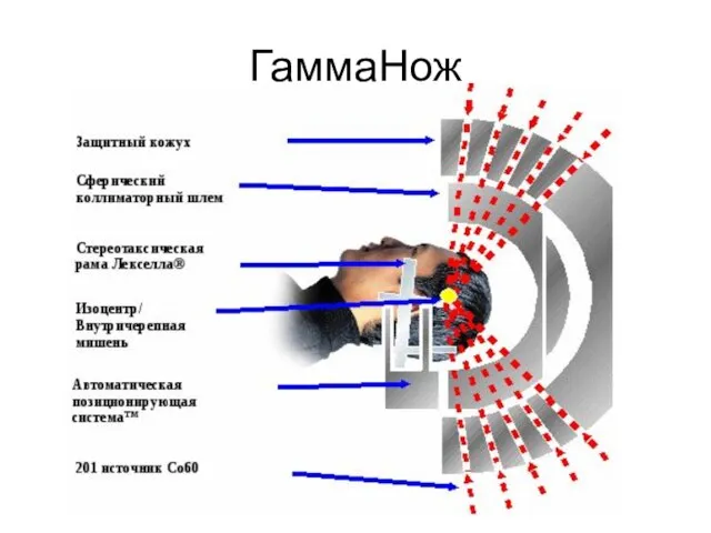 ГаммаНож