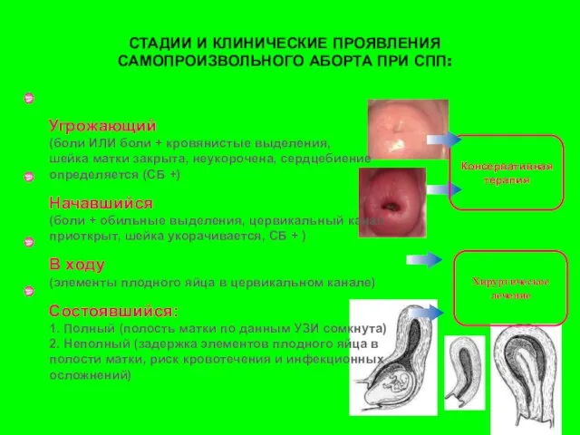 СТАДИИ И КЛИНИЧЕСКИЕ ПРОЯВЛЕНИЯ САМОПРОИЗВОЛЬНОГО АБОРТА ПРИ СПП: Угрожающий (боли ИЛИ