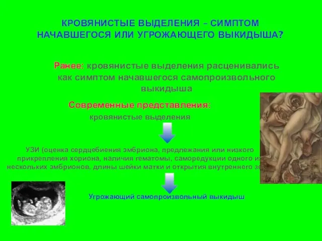 КРОВЯНИСТЫЕ ВЫДЕЛЕНИЯ – СИМПТОМ НАЧАВШЕГОСЯ ИЛИ УГРОЖАЮЩЕГО ВЫКИДЫША? Современные представления: кровянистые