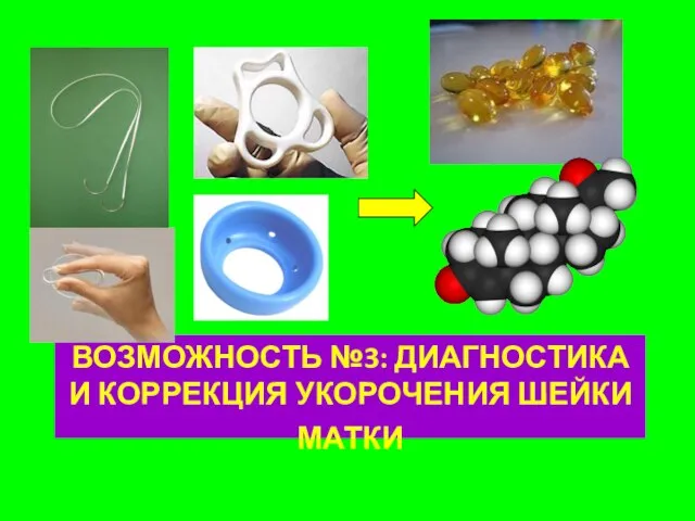 ВОЗМОЖНОСТЬ №3: ДИАГНОСТИКА И КОРРЕКЦИЯ УКОРОЧЕНИЯ ШЕЙКИ МАТКИ