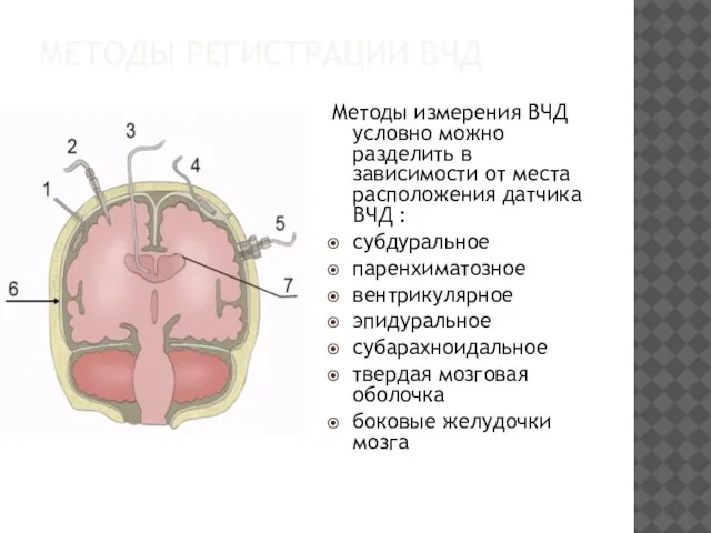 МЕТОДЫ РЕГИСТРАЦИИ ВЧД Методы измерения ВЧД условно можно разделить в зависимости