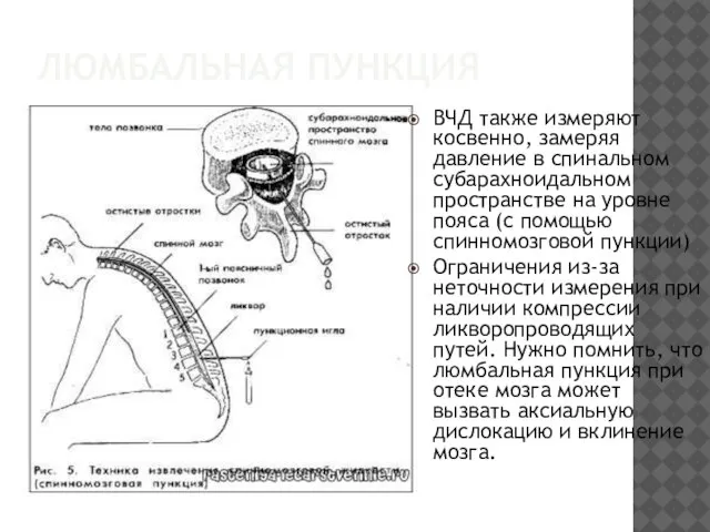 ЛЮМБАЛЬНАЯ ПУНКЦИЯ ВЧД также измеряют косвенно, замеряя давление в спинальном субарахноидальном