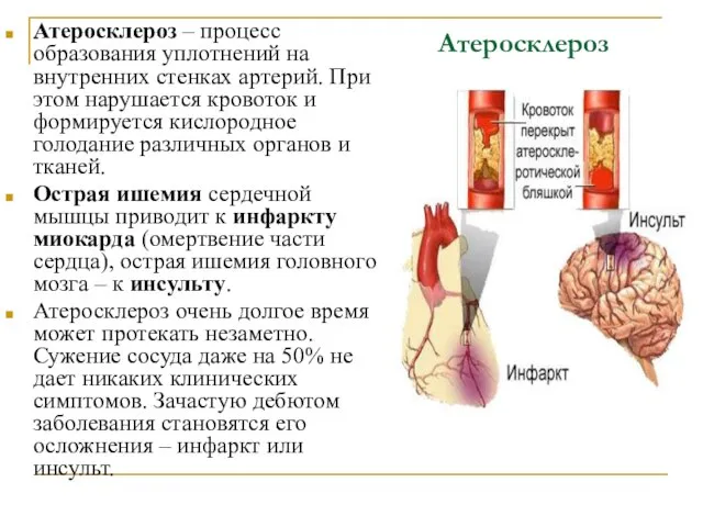 Атеросклероз Атеросклероз – процесс образования уплотнений на внутренних стенках артерий. При