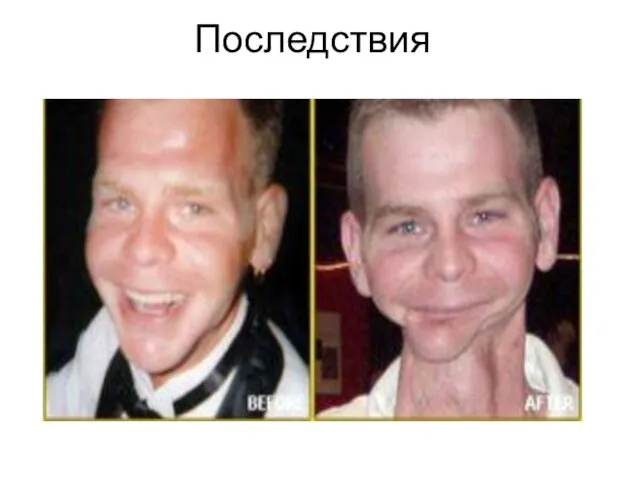 Последствия