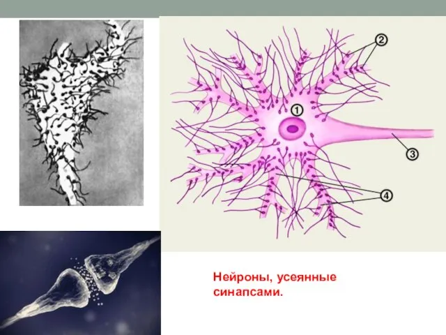 Нейроны, усеянные синапсами.