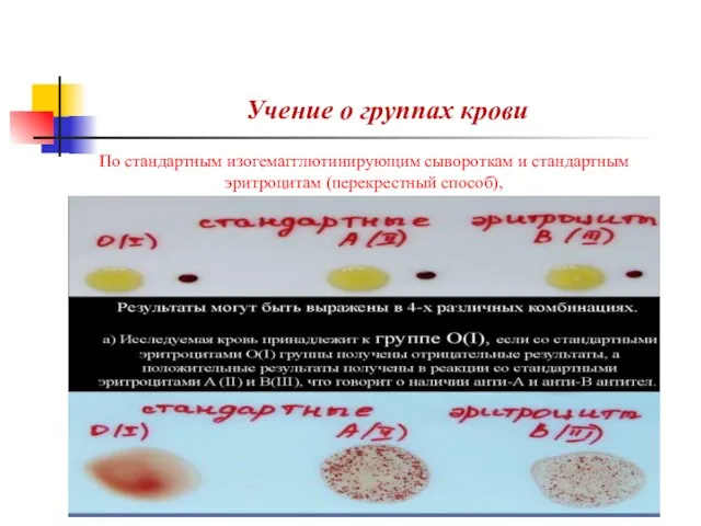 Учение о группах крови По стандартным изогемагглютинирующим сывороткам и стандартным эритроцитам (перекрестный способ),