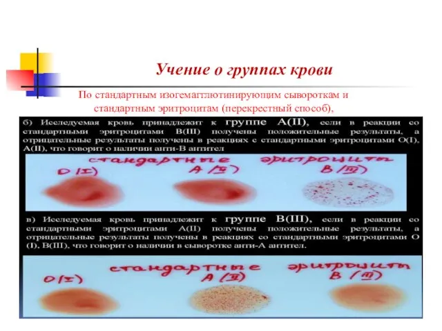 Учение о группах крови По стандартным изогемагглютинирующим сывороткам и стандартным эритроцитам (перекрестный способ),