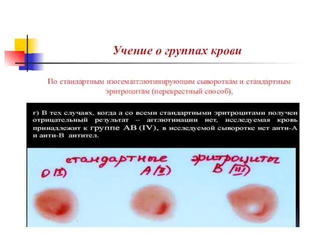 Учение о группах крови По стандартным изогемагглютинирующим сывороткам и стандартным эритроцитам (перекрестный способ),