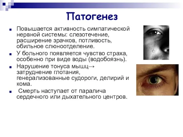 Патогенез Повышается активность симпатической нервной системы: слезотечение, расширение зрачков, потливость, обильное