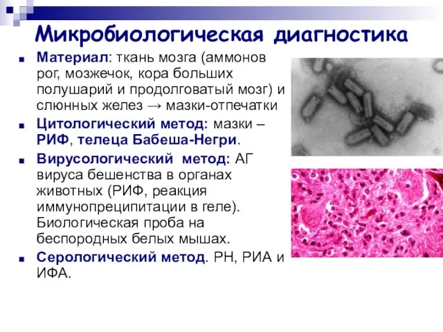 Микробиологическая диагностика Материал: ткань мозга (аммонов рог, мозжечок, кора больших полушарий