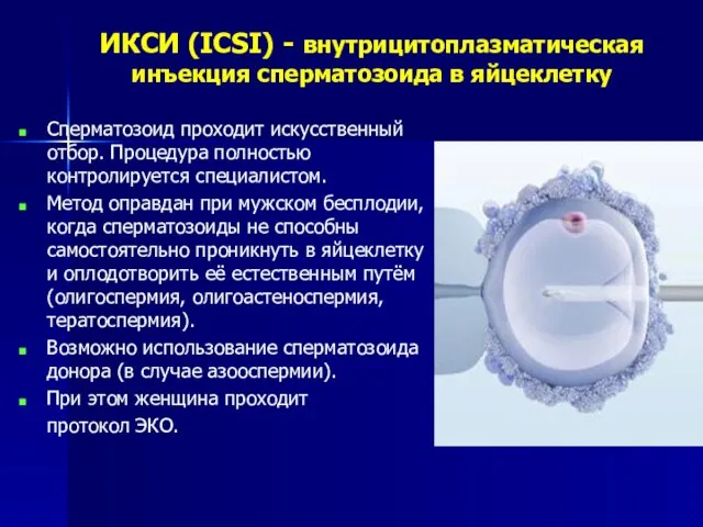 ИКСИ (ICSI) - внутрицитоплазматическая инъекция сперматозоида в яйцеклетку Сперматозоид проходит искусственный