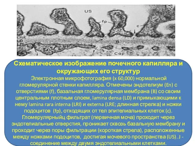 Схематическое изображение почечного капилляра и окружающих его структур Электронная микрофотография (x