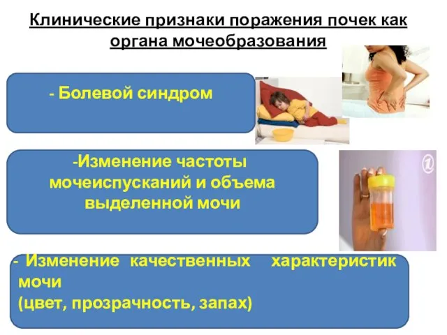 Клинические признаки поражения почек как органа мочеобразования Изменение качественных характеристик мочи