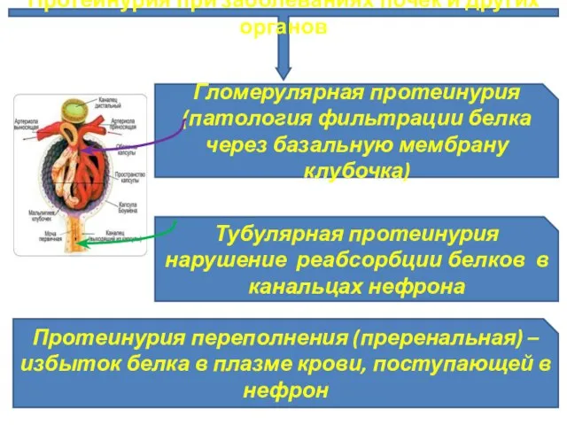 Протеинурия при заболеваниях почек и других органов Гломерулярная протеинурия (патология фильтрации