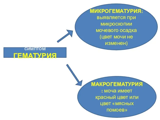 симптом ГЕМАТУРИЯ МИКРОГЕМАТУРИЯ: выявляется при микроскопии мочевого осадка (цвет мочи не