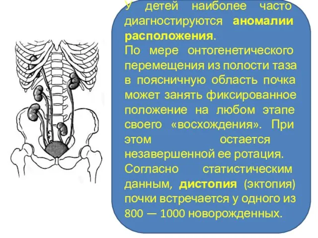 У детей наиболее часто диагностируются аномалии расположения. По мере онтогенетического перемещения