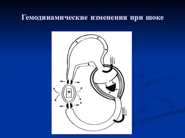 Гемодинамические изменения при шоке