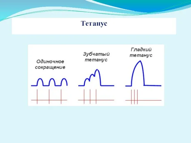 Тетанус