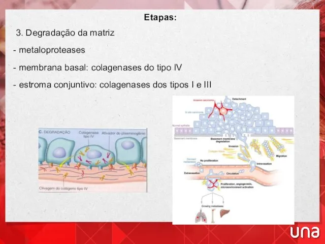 Etapas: 3. Degradação da matriz - metaloproteases - membrana basal: colagenases