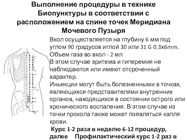 Выполнение процедуры в технике Биопунктуры в соответствии с расположением на спине