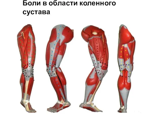 Боли в области коленного сустава