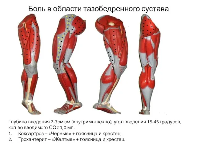 Боль в области тазобедренного сустава Боль в области тазобедренного сустава Глубина