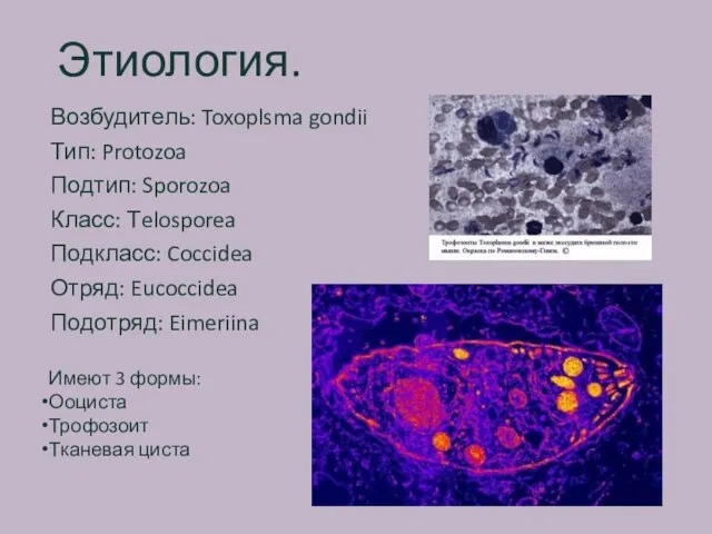 Этиология. Возбудитель: Toxoplsma gondii Тип: Protozoa Подтип: Sporozoa Класс: Тelosporea Подкласс: