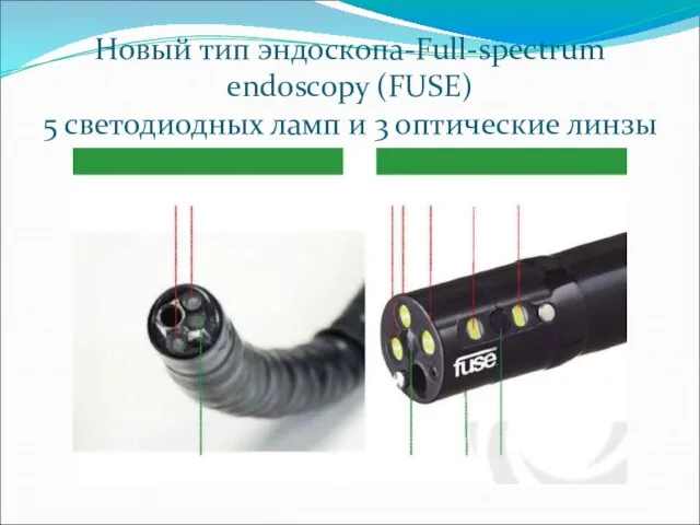 Новый тип эндоскопа-Full-spectrum endoscopy (FUSE) 5 светодиодных ламп и 3 оптические линзы