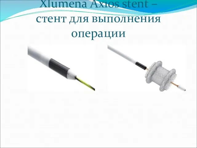 Xlumena Axios stent – стент для выполнения операции