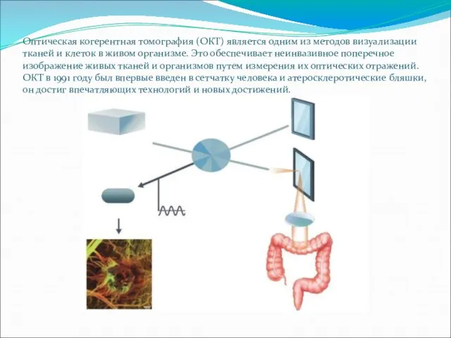 Оптическая когерентная томография (ОКТ) является одним из методов визуализации тканей и