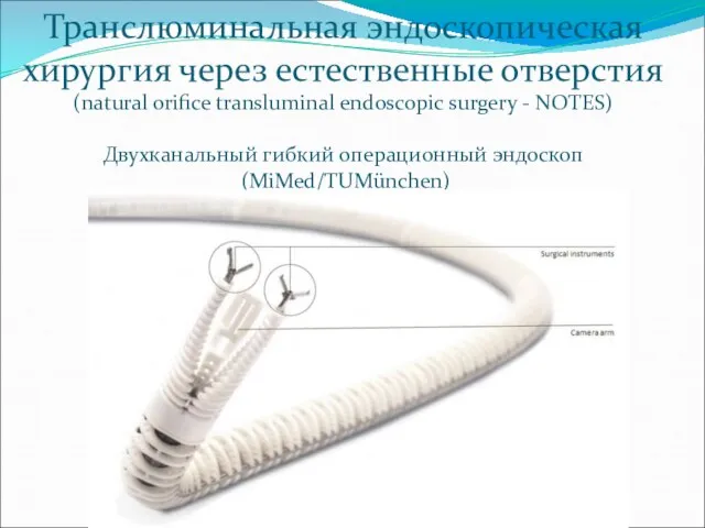 Транслюминальная эндоскопическая хирургия через естественные отверстия (natural orifice transluminal endoscopic surgery