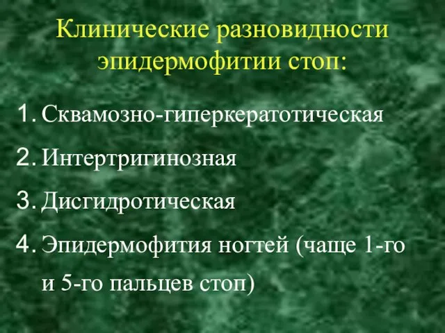 Клинические разновидности эпидермофитии стоп: Сквамозно-гиперкератотическая Интертригинозная Дисгидротическая Эпидермофития ногтей (чаще 1-го и 5-го пальцев стоп)