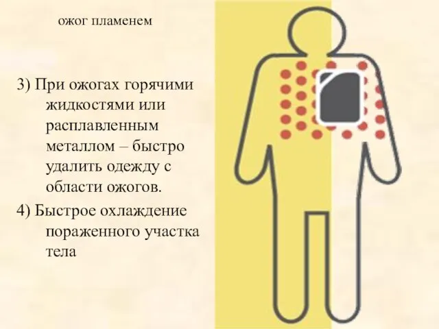 3) При ожогах горячими жидкостями или расплавленным металлом – быстро удалить