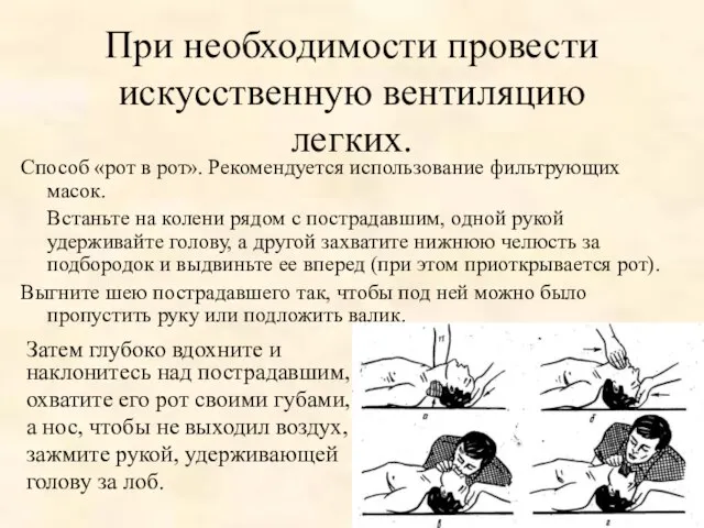 При необходимости провести искусственную вентиляцию легких. Способ «рот в рот». Рекомендуется