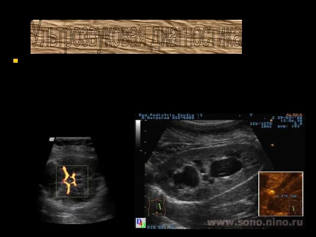 Метод основан на применении ультразвука для выявления различных структур органов и