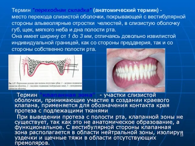 Термин "переходная складка" (анатомический термин) - место перехода слизистой оболочки, покрывающей