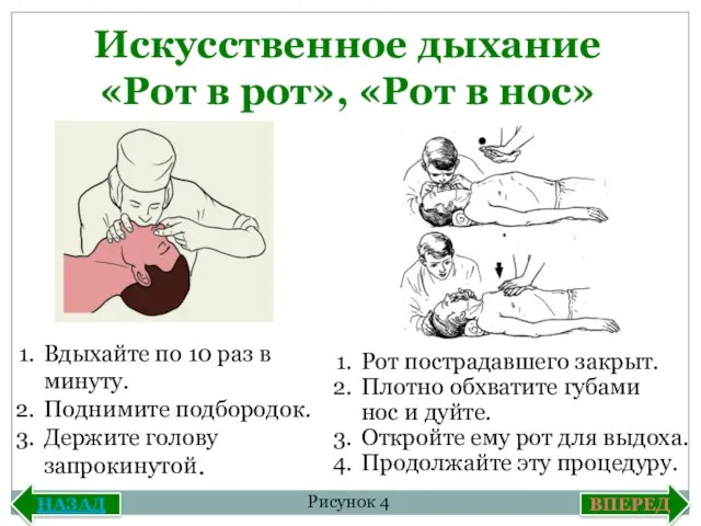 Искусственное дыхание «Рот в рот», «Рот в нос» Вдыхайте по 10