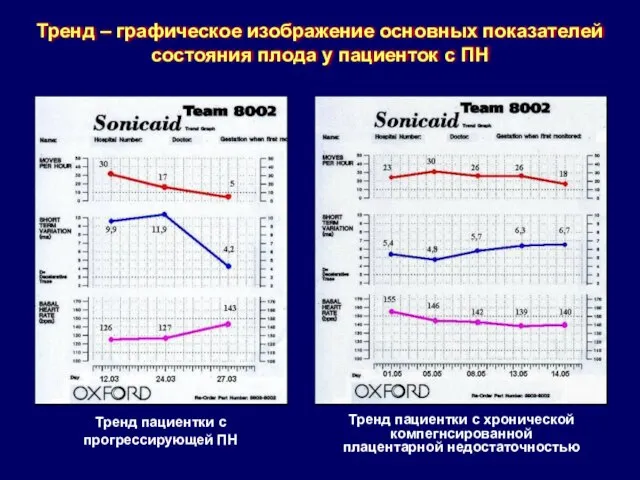 Тренд пациентки с хронической компегнсированной плацентарной недостаточностью Тренд пациентки с прогрессирующей