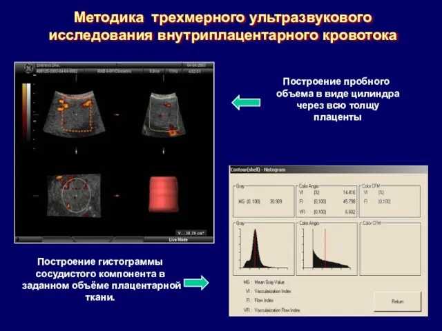 Методика трехмерного ультразвукового исследования внутриплацентарного кровотока Построение пробного объема в виде