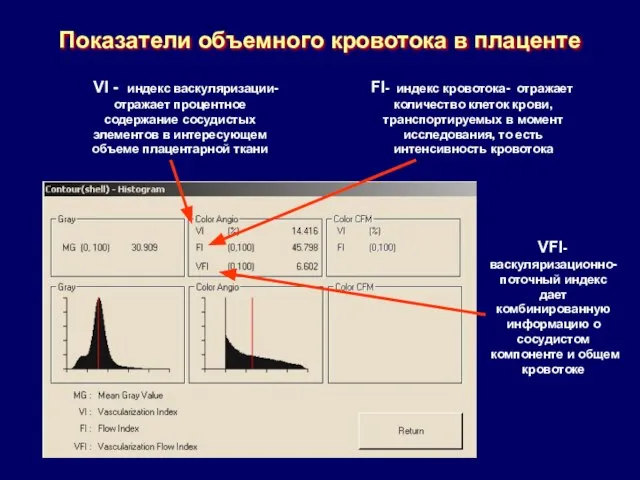 Показатели объемного кровотока в плаценте VI - индекс васкуляризации- отражает процентное