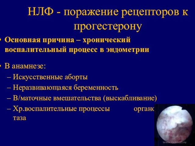 НЛФ - поражение рецепторов к прогестерону Основная причина – хронический воспалительный