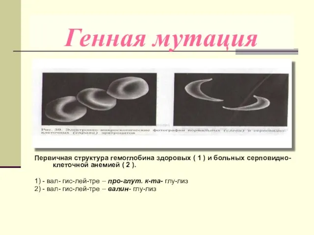 Генная мутация Первичная структура гемоглобина здоровых ( 1 ) и больных