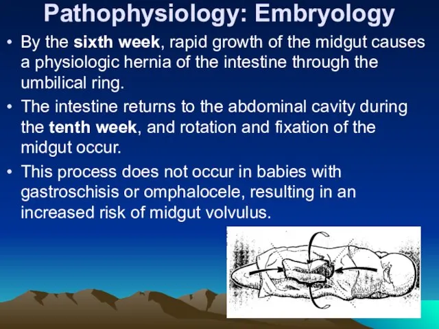 Pathophysiology: Embryology By the sixth week, rapid growth of the midgut