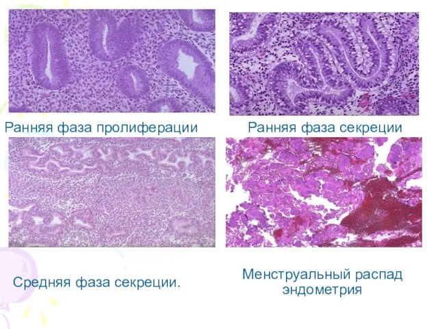 Ранняя фаза пролиферации Ранняя фаза секреции Средняя фаза секреции. Менструальный распад эндометрия